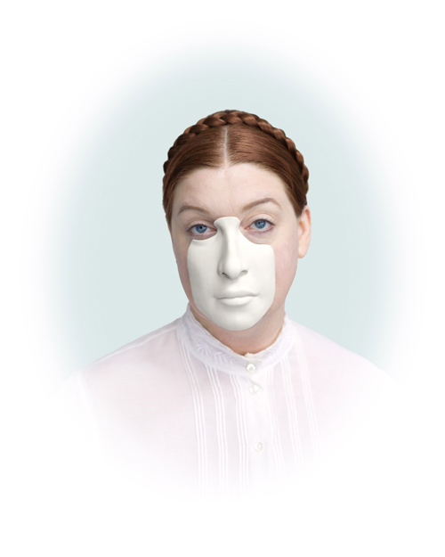 Teri Frame "Self-portrait with Facial Prosthetic V" Inkjet print  Photo Credit Doug DuBois